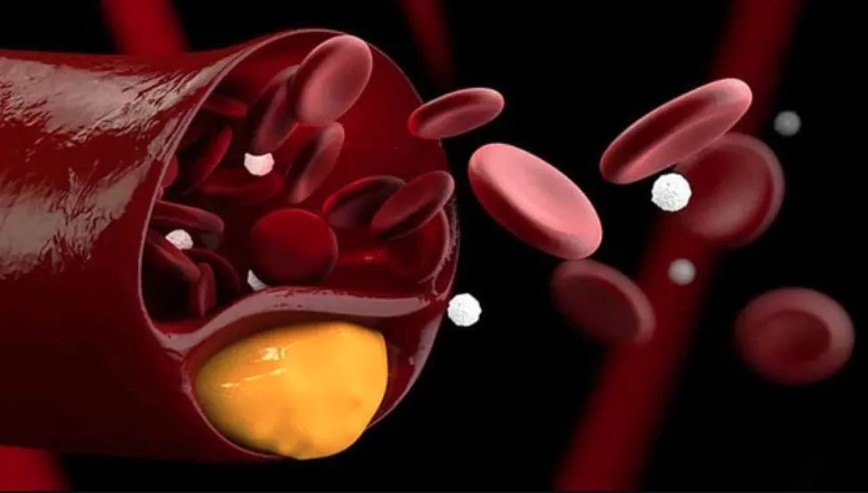 hieu-dung-ve-cholesterol-khi-nao-can-dieu-tri-va-khi-nao-khong